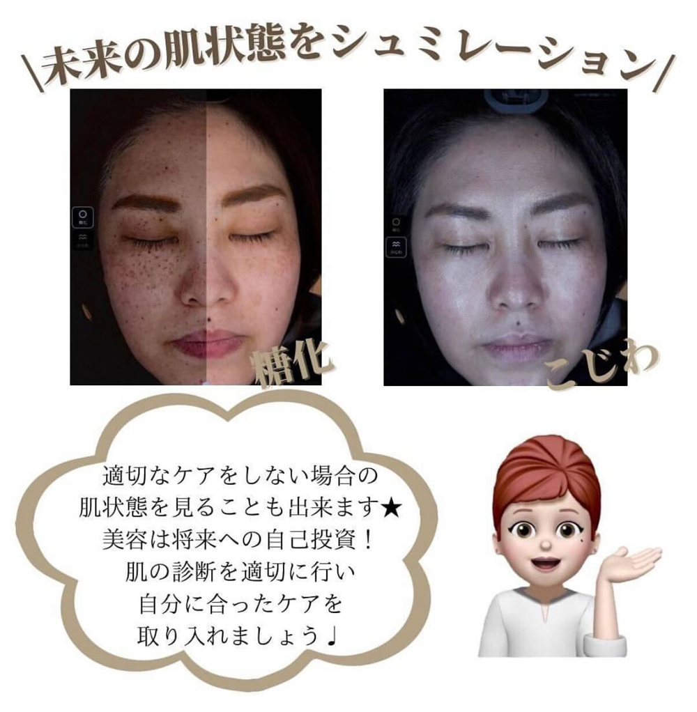 肌状態をシュミレーション